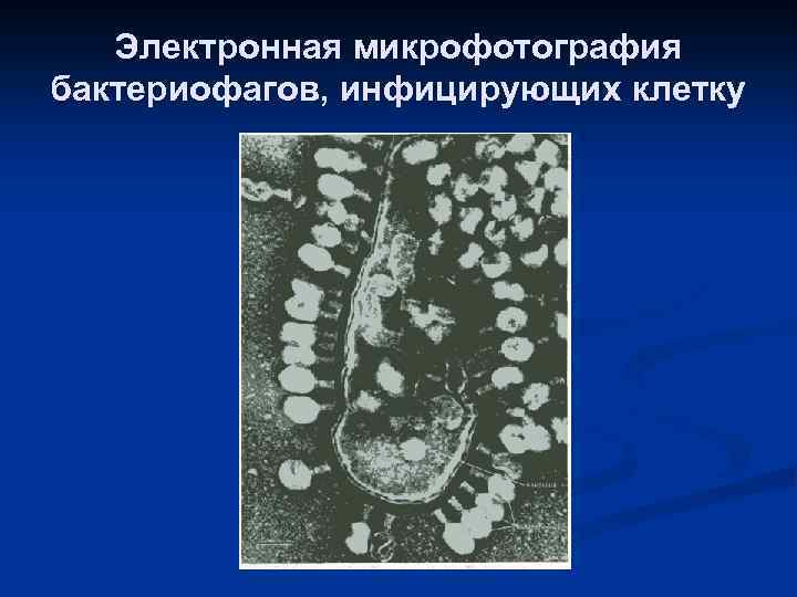 Электронная микрофотография бактериофагов, инфицирующих клетку 