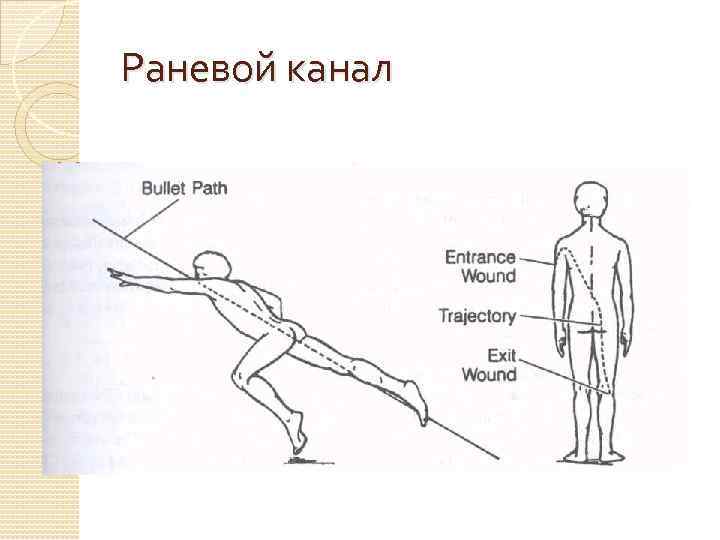 Раневой канал 