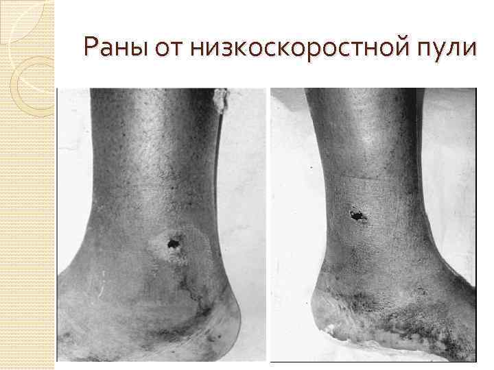 Раны от низкоскоростной пули 