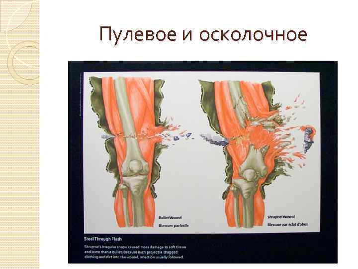  Пулевое и осколочное 