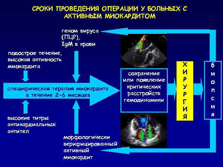 СРОКИ ПРОВЕДЕНИЯ ОПЕРАЦИИ У БОЛЬНЫХ С АКТИВНЫМ МИОКАРДИТОМ геном вируса (ПЦР), Ig. M в