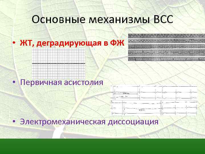 Основные механизмы ВСС • ЖТ, деградирующая в ФЖ • Первичная асистолия • Электромеханическая диссоциация