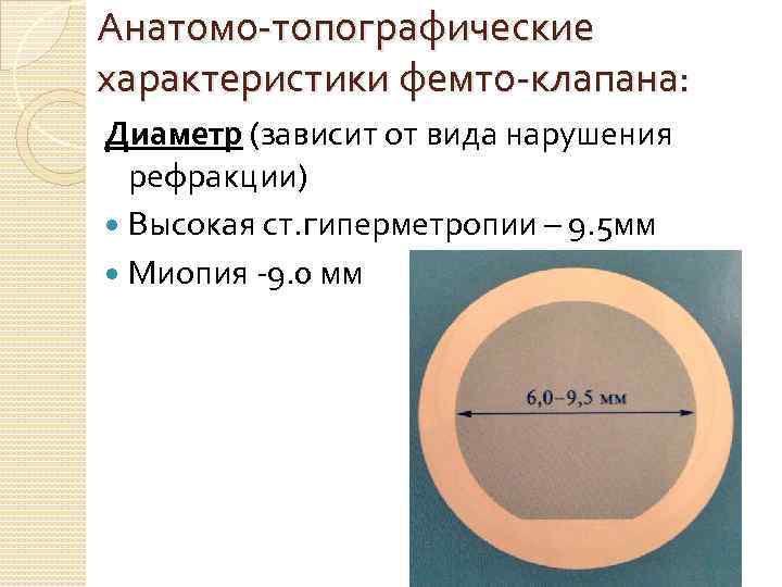 Анатомо-топографические характеристики фемто-клапана: Диаметр (зависит от вида нарушения рефракции) Высокая ст. гиперметропии – 9.