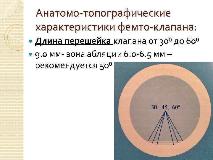 Анатомо-топографические характеристики фемто-клапана: Длина перешейка клапана от 30⁰ до 60⁰ 9. 0 мм- зона