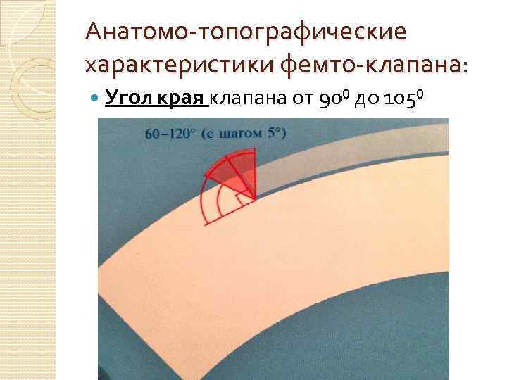 Анатомо-топографические характеристики фемто-клапана: Угол края клапана от 90⁰ до 105⁰ 