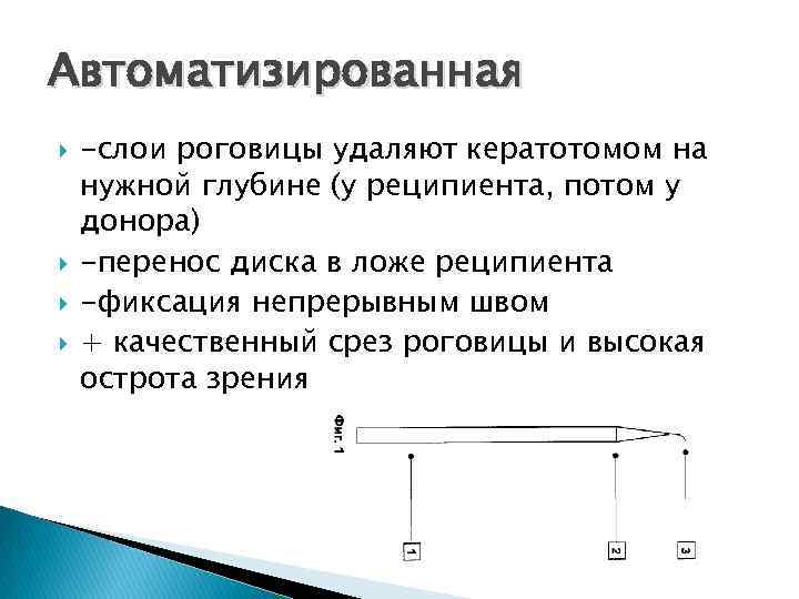 Автоматизированная -слои роговицы удаляют кератотомом на нужной глубине (у реципиента, потом у донора) -перенос