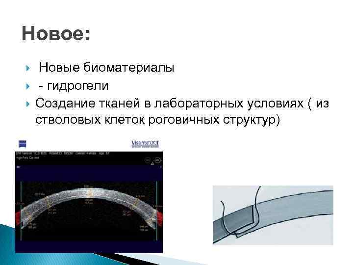 Новое: Новые биоматериалы - гидрогели Создание тканей в лабораторных условиях ( из стволовых клеток