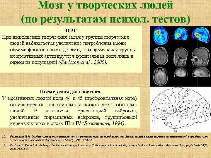 Мозг у творческих людей (по результатам психол. тестов) ПЭТ При выполнении творческих задач у
