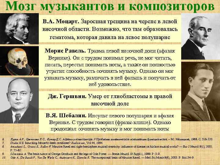 Мозг музыкантов и композиторов В. А. Моцарт. Заросшая трещина на черепе в левой височной