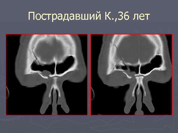 Пострадавший К. , 36 лет 