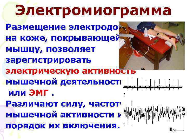 Электрическая активность мышц