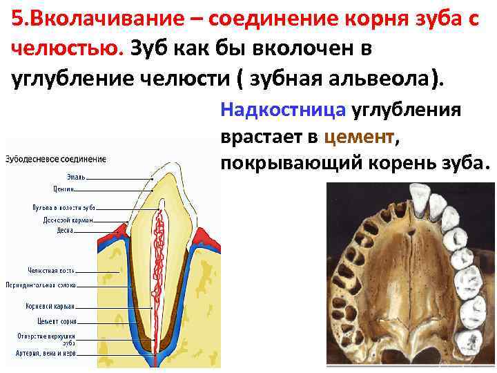 Как зубы крепятся к челюсти картинки