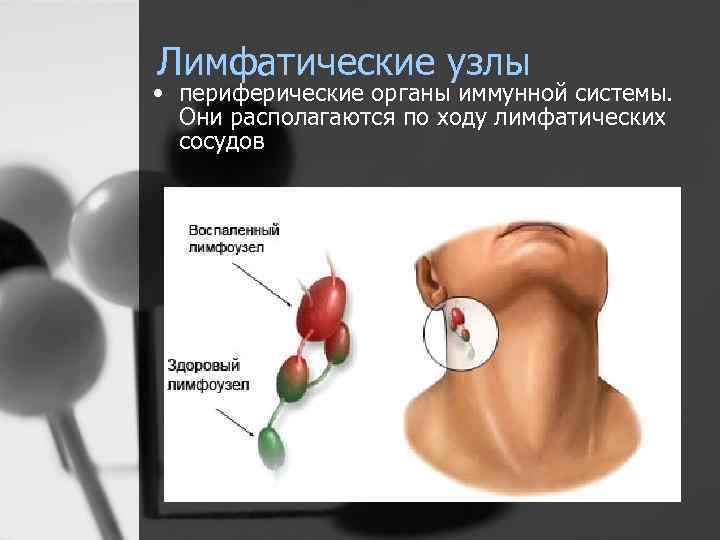 Периферические лимфоузлы где находятся у женщин фото