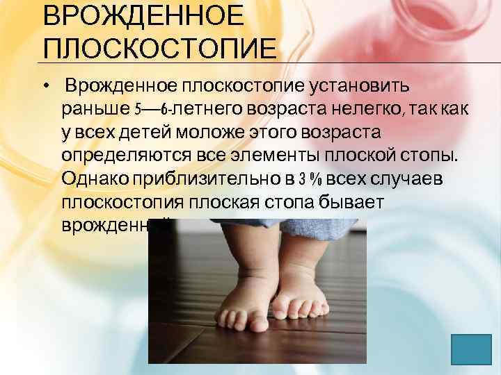 Плоскостопие у детей картинки