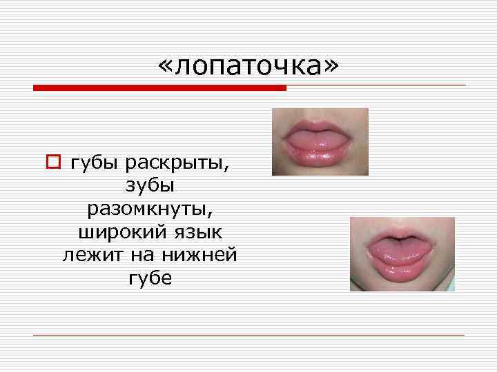  «лопаточка» o губы раскрыты, зубы разомкнуты, широкий язык лежит на нижней губе 