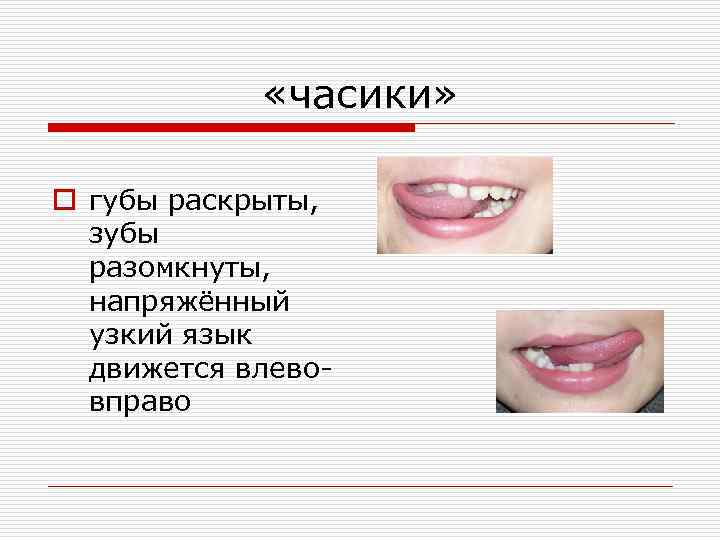  «часики» o губы раскрыты, зубы разомкнуты, напряжённый узкий язык движется влевовправо 