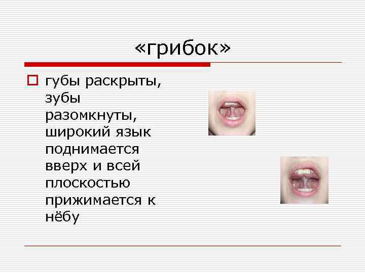  «грибок» o губы раскрыты, зубы разомкнуты, широкий язык поднимается вверх и всей плоскостью