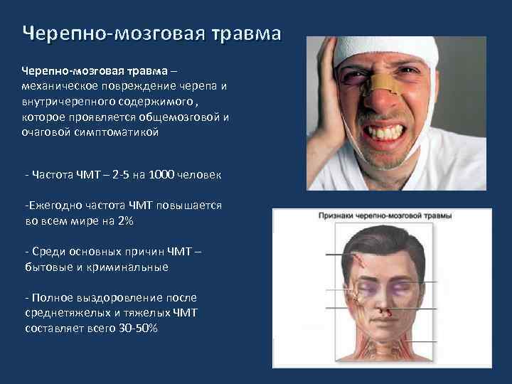 Черепно-мозговая травма – механическое повреждение черепа и внутричерепного содержимого , которое проявляется общемозговой и