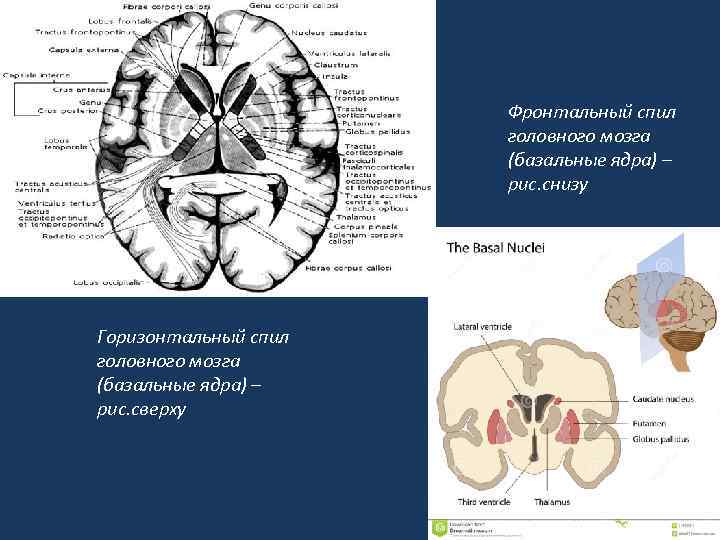 Фронтальный спил головного мозга (базальные ядра) – рис. снизу Горизонтальный спил головного мозга (базальные