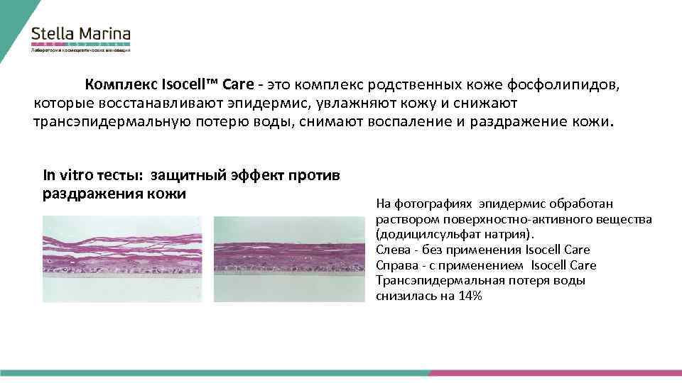 Комплекс Isocell™ Care - это комплекс родственных коже фосфолипидов, которые восстанавливают эпидермис, увлажняют кожу