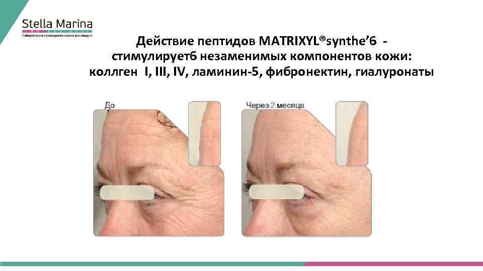 Действие пептидов MATRIXYL®synthe’ 6 - стимулирует6 незаменимых компонентов кожи: коллген I, III, IV, ламинин-5,