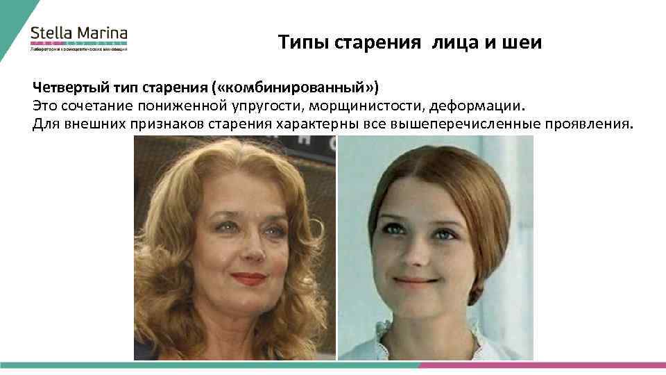 Типы старения лица и шеи Четвертый тип старения ( «комбинированный» ) Это сочетание пониженной