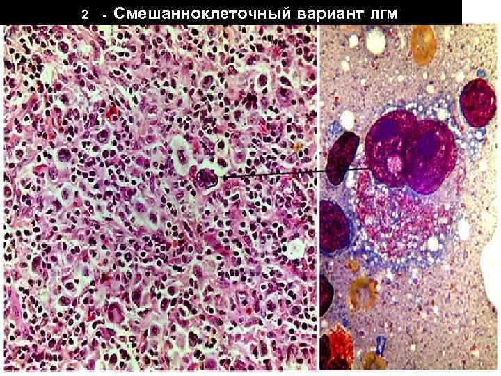 Костный мозг фото