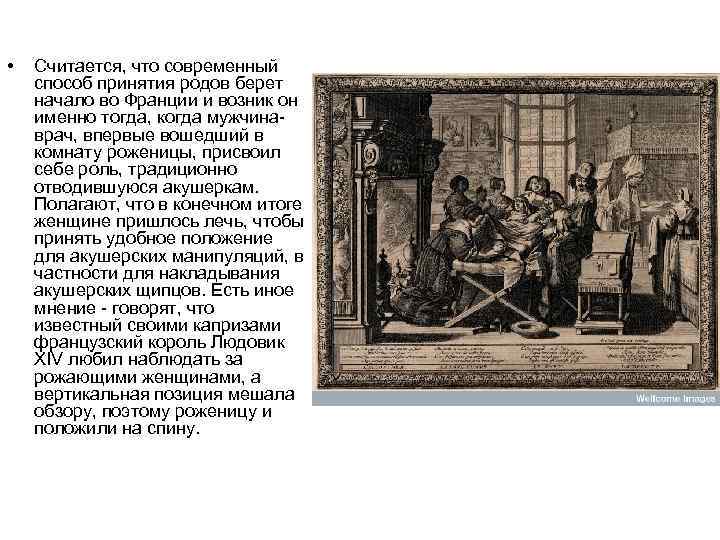  • Считается, что современный способ принятия родов берет начало во Франции и возник