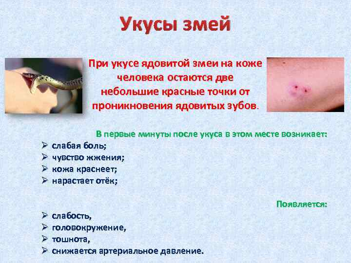 Укусы змей При укусе ядовитой змеи на коже человека остаются две небольшие красные точки