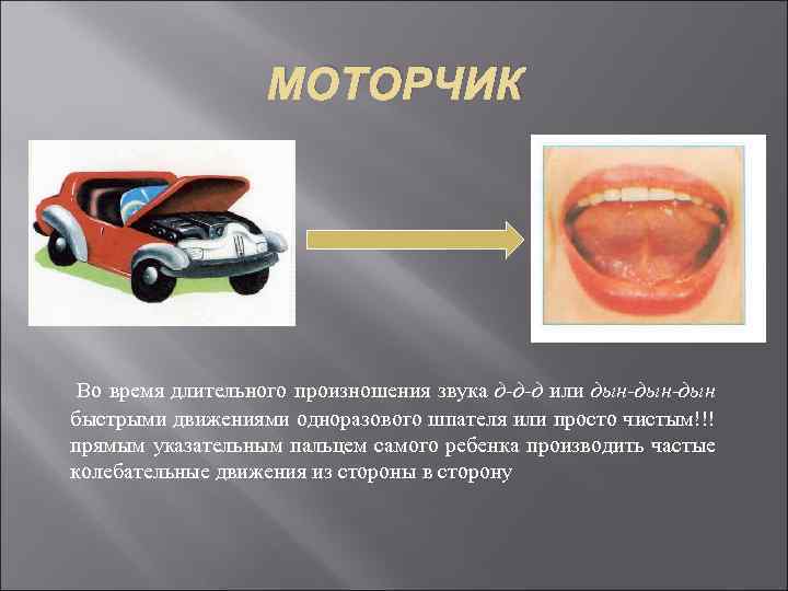 МОТОРЧИК Во время длительного произношения звука д-д-д или дын-дын быстрыми движениями одноразового шпателя или
