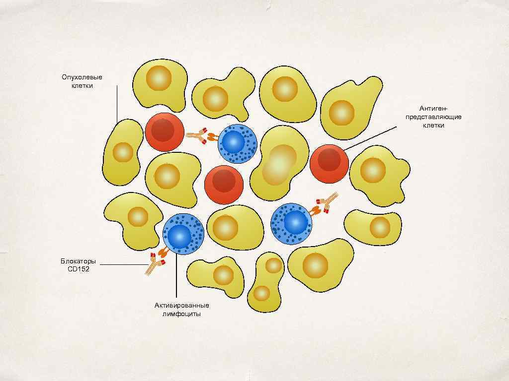 Опухолевые клетки Антигенпредставляющие клетки Блокаторы CD 152 Активированные лимфоциты 