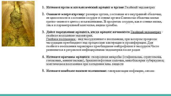 1. Назовите орган и патологический процесс в органе Гнойный эндометрит 2. Опишите макро картину: