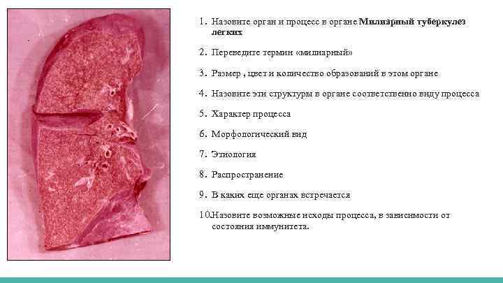 1. Назовите орган и процесс в органе Милиарный туберкулез легких 2. Переведите термин «милиарный»