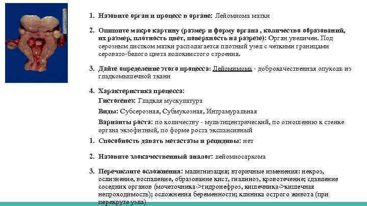 1. Назовите орган и процесс в органе: Лейомиома матки 2. Опишите макро картину (размер