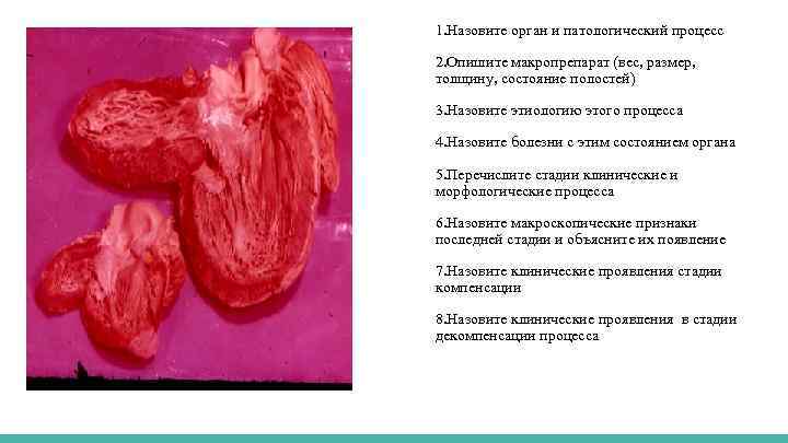 1. Назовите орган и патологический процесс 2. Опишите макропрепарат (вес, размер, толщину, состояние полостей)