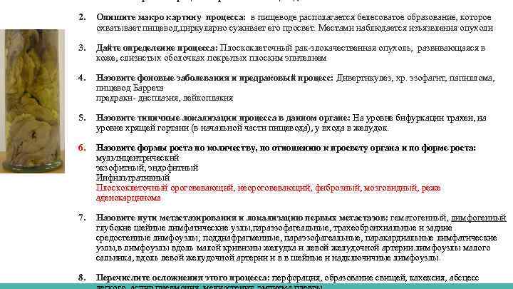 1. Назовите орган и процесс в органе: Рак пищевода 2. Опишите макро картину процесса: