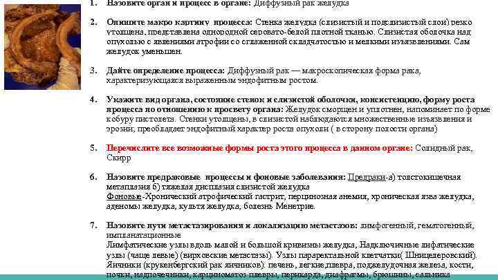 1. Назовите орган и процесс в органе: Диффузный рак желудка 2. Опишите макро картину