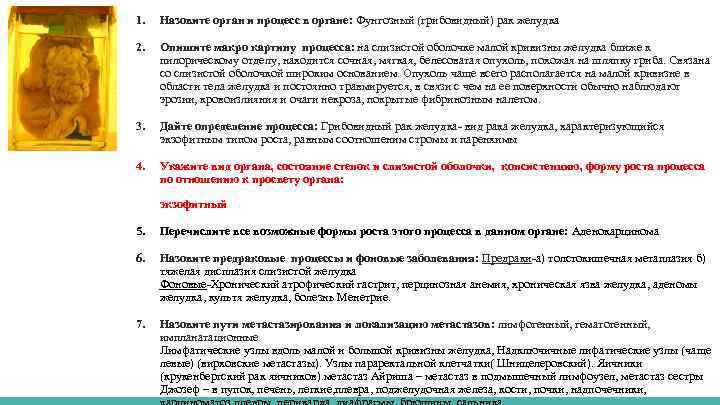 1. Назовите орган и процесс в органе: Фунгозный (грибовидный) рак желудка 2. Опишите макро