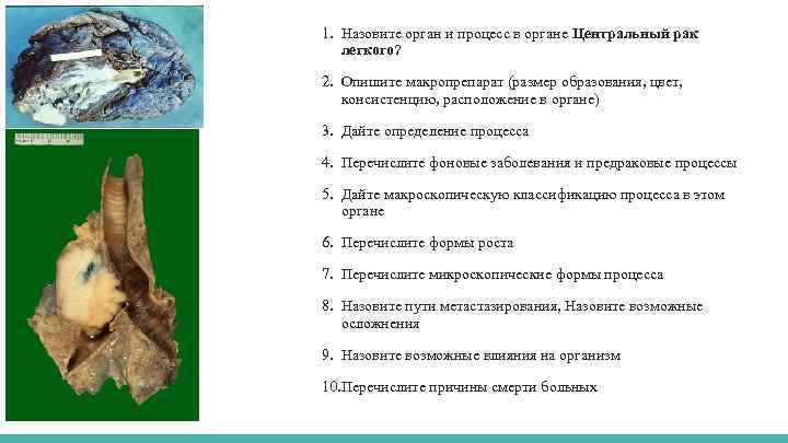 1. Назовите орган и процесс в органе Центральный рак легкого? 2. Опишите макропрепарат (размер