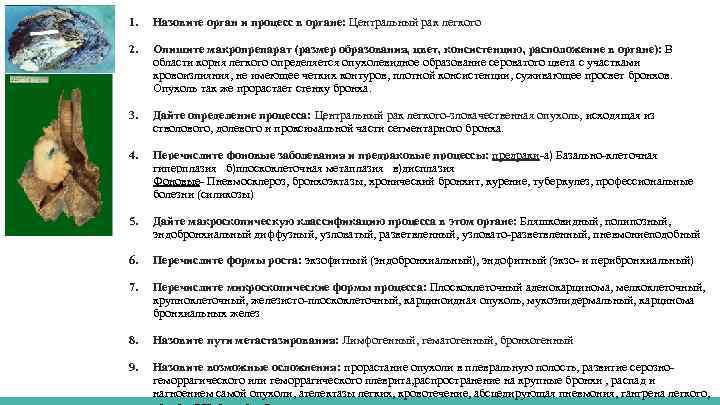 1. Назовите орган и процесс в органе: Центральный рак легкого 2. Опишите макропрепарат (размер