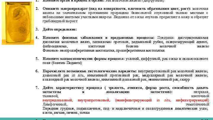 1. Назовите орган и процесс в органе: Рак молочной железы (диффузный) 2. Опишите макропрепарат