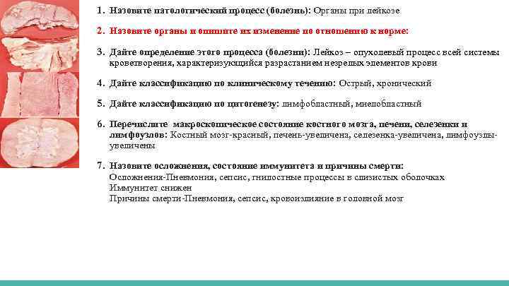 1. Назовите патологический процесс (болезнь): Органы при лейкозе 2. Назовите органы и опишите их