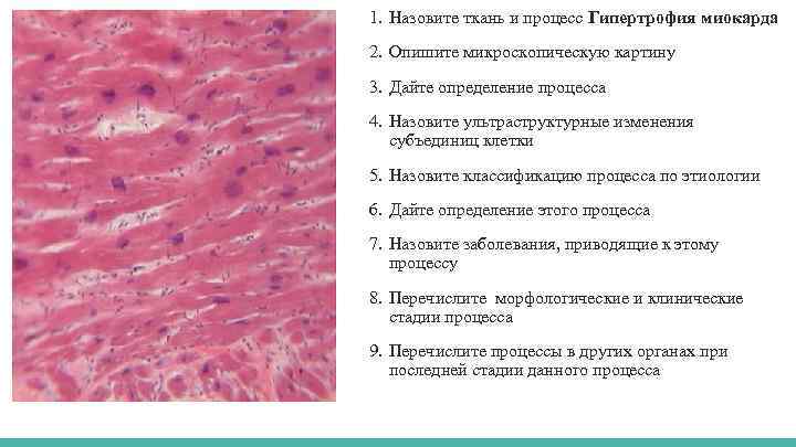 1. Назовите ткань и процесс Гипертрофия миокарда 2. Опишите микроскопическую картину 3. Дайте определение