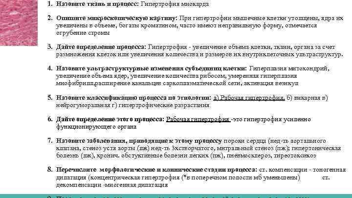 1. Назовите ткань и процесс: Гипертрофия миокарда 2. Опишите микроскопическую картину: При гипертрофии мышечные