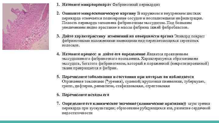 1. Назовите микропрепарат Фибринозный перикардит 2. Опишите микроскопическую картину В наружном и внутреннем листках