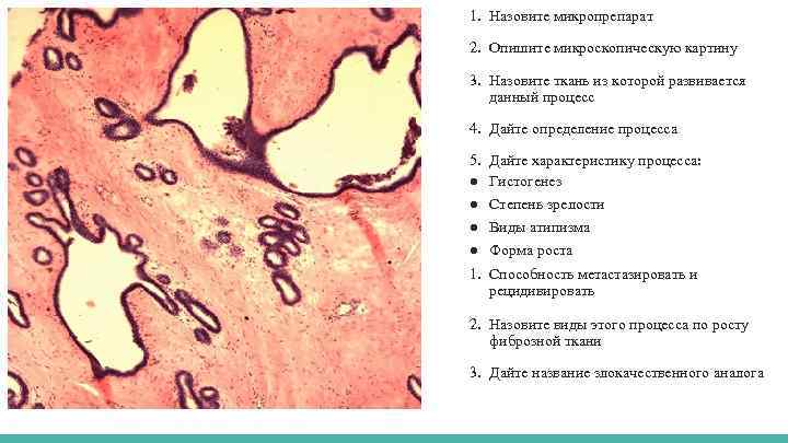 1. Назовите микропрепарат 2. Опишите микроскопическую картину 3. Назовите ткань из которой развивается данный