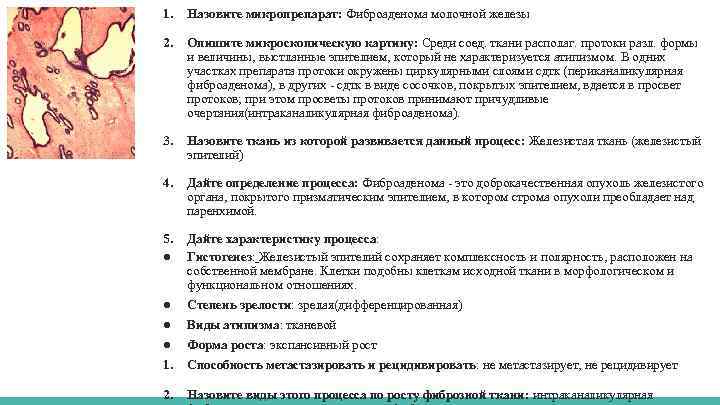 1. Назовите микропрепарат: Фиброаденома молочной железы 2. Опишите микроскопическую картину: Среди соед. ткани располаг.