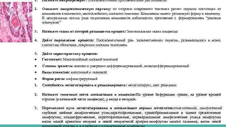 1. Назовите микропрепарат: Плоскоклеточный ороговевающий рак пишевода 2. Опишите микроскопическую картину: со стороны покровного