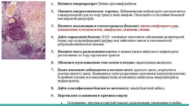 1. Назовите микропрепарат Печень при лимфолейкозе 2. Опишите микроскопическую картину: Лейкемические инфильтраты располагаются в