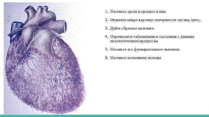 1. Назовите орган и процесс в нем 2. Опишите макро картину: поверхность органа, цвет,